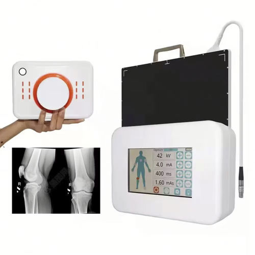 Sistema di radiografia digitale - FTLF360 - Fatali Medical - per radiografia multidisciplinare / portatile