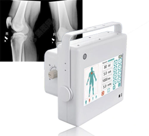 Generatore di raggi X per radiografia multidisciplinare - FTLF10 - Fatali Medical - portatile / con pannello di comando / con batteria
