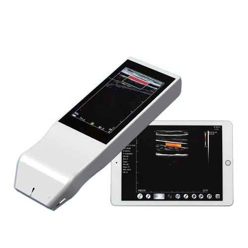 Ecografo palmare - FTL-V5L - Fatali Medical - per ecografia multidisciplinare / con doppler a colori / in bianco e nero