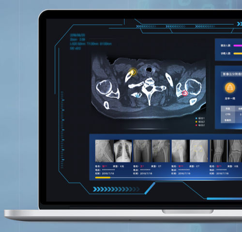 PACS con cloud computing - NovaCloud® - Huiying Medical Technology (Beijing) Co., Ltd. - medico
