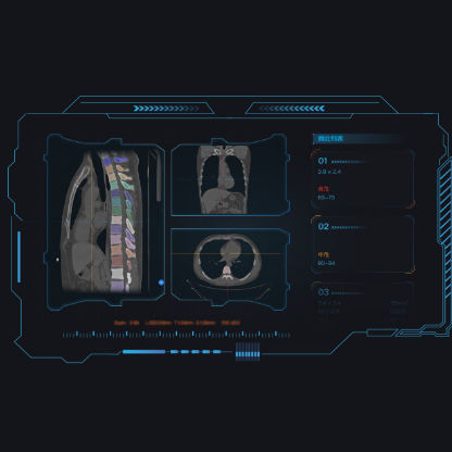 Applicazione web di visualizzazione - Dr. Turing® - Huiying Medical Technology (Beijing) Co., Ltd. - di analisi / medica / per tomografia computerizzata
