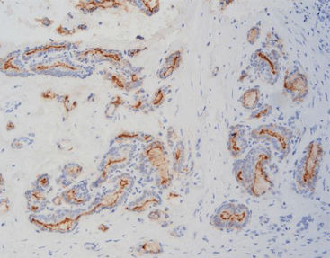 Reagente in soluzione - FHM0010 - Celnovte Biotechnology Co., Ltd. - per immunoistochimica / di marcatori tumorali / estratto dal topo