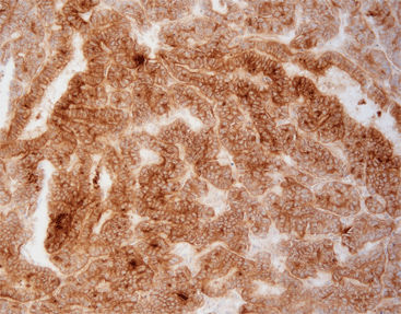 Reagente anticorpo - FGM0011 - Celnovte Biotechnology Co., Ltd. - oncologico / di origine animale