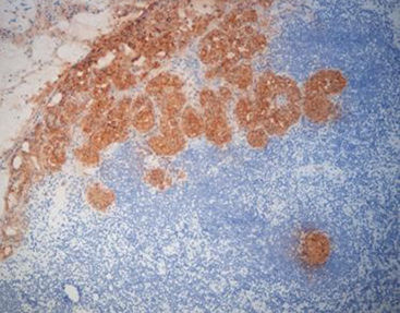 Reagente anticorpo - FCM0170 - Celnovte Biotechnology Co., Ltd. - oncologico / estratto dal topo