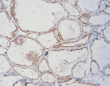 Reagente per tessuti - FCM0080 - Celnovte Biotechnology Co., Ltd. - per immunoistochimica / di glicoproteine