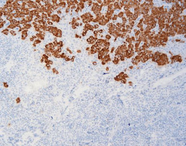 Reagente anticorpo - FCM0200 - Celnovte Biotechnology Co., Ltd. - per immunoistochimica / di proteine / estratto dal topo