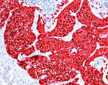 Kit di reagenti soluzione colorante - SD8001 - Celnovte Biotechnology Co., Ltd. - per immunoistochimica / di fosfatasi alcalina / cromogenico