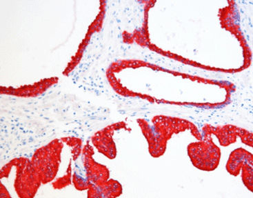 Kit di reagenti colorante - SD8006 - Celnovte Biotechnology Co., Ltd. - per tessuti / per immunoistochimica / di fosfatasi alcalina