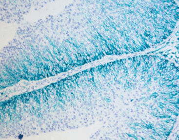 Kit di reagenti colorante - SD8005 - Celnovte Biotechnology Co., Ltd. - per tessuti / per immunoistochimica
