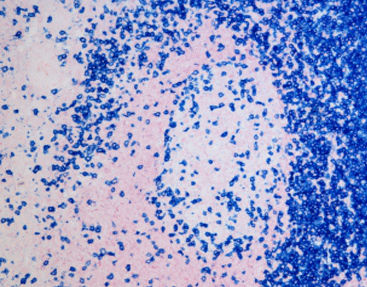 Kit di reagenti colorante - SD8004 - Celnovte Biotechnology Co., Ltd. - per tessuti / per immunoistochimica