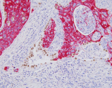 Kit di reagenti soluzione colorante - SD8103 - Celnovte Biotechnology Co., Ltd. - per tessuti / per immunoistochimica