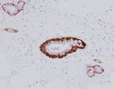 Kit di reagenti soluzione colorante - SD8106 - Celnovte Biotechnology Co., Ltd. - per tessuti / per immunoistochimica