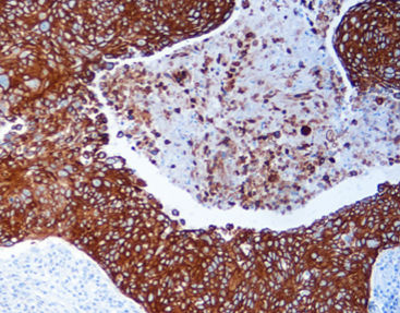 Kit di reagenti colorante - MicroStacker™  - Celnovte Biotechnology Co., Ltd. - soluzione colorante / enzima / anticorpo