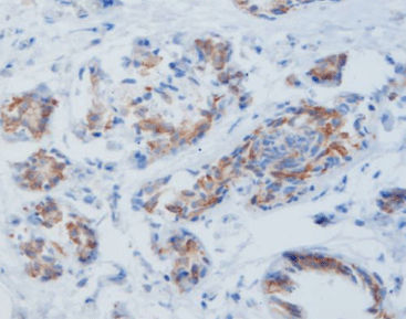 Kit di reagenti colorante - MicroStacker™  - Celnovte Biotechnology Co., Ltd. - soluzione colorante / enzima / anticorpo