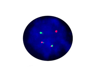 Kit di test di gene di fusione EML4-ALK - CF1012 - Celnovte Biotechnology Co., Ltd. - della febbre tifoide / da ricerca / del cancro del polmone