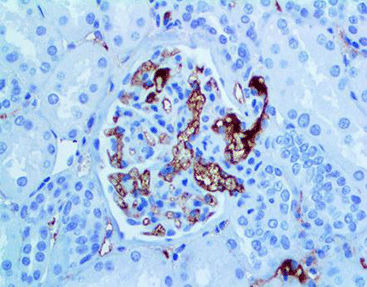 Reagente anticorpo monoclonale - CIM-0140 - Celnovte Biotechnology Co., Ltd. - anticorpo policlonale / da ricerca / per tessuti
