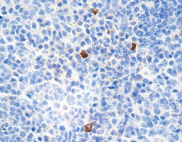 Reagente per immunoglobuline G4 - CIR-0131 - Celnovte Biotechnology Co., Ltd. - soluzione colorante / anticorpo monoclonale / anticorpo policlonale