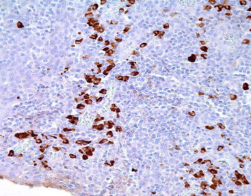 Reagente di immunoglobuline A - CIR-0101 - Celnovte Biotechnology Co., Ltd. - soluzione colorante / anticorpo / anticorpo policlonale