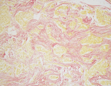 Kit di reagenti soluzione colorante - Van Gieson - Celnovte Biotechnology Co., Ltd. - per istologia