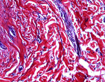 Kit di reagenti colorante - Celnovte Biotechnology Co., Ltd. - collagene / per istologia