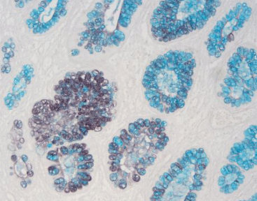 Kit di reagenti colorante - HID-AB - Celnovte Biotechnology Co., Ltd. - per istologia / di pH / di cloruro