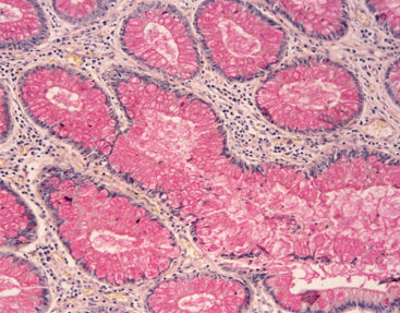 Kit di reagenti colorante - Celnovte Biotechnology Co., Ltd. - per istologia / di Cryptococcus neoformans