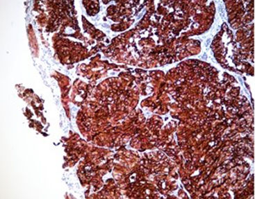 Reagente colorante - SD8002 - Celnovte Biotechnology Co., Ltd. - per immunoistochimica / di fosfatasi alcalina / cromogenico