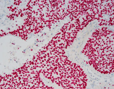 Reagente colorante - SD8003 - Celnovte Biotechnology Co., Ltd. - per tessuti / per immunoistochimica / di fosfatasi alcalina