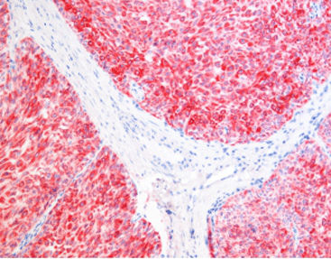 Reagente soluzione colorante - SD8007 - Celnovte Biotechnology Co., Ltd. - per tessuti / per immunoistochimica / di fosfatasi alcalina
