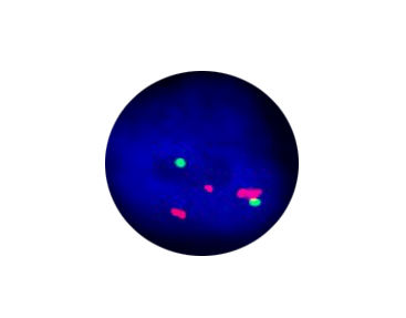 Kit di test della febbre tifoide - CF1307 - Celnovte Biotechnology Co., Ltd. - da ricerca / oncologico / genetico