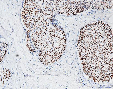 Reagente anticorpo monoclonale - CPM-0365 - Celnovte Biotechnology Co., Ltd. - anticorpo policlonale / da ricerca / per tessuti