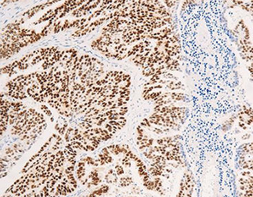 Reagente anticorpo monoclonale - CEM-0081 - Celnovte Biotechnology Co., Ltd. - anticorpo policlonale / da ricerca / per tessuti