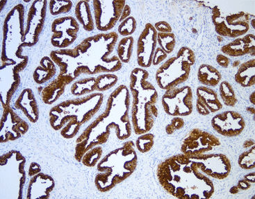 Reagente anticorpo monoclonale - CPM-0404 - Celnovte Biotechnology Co., Ltd. - anticorpo policlonale / enzima / proteasi
