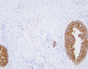 Reagente anticorpo monoclonale - CCM-0833 - Celnovte Biotechnology Co., Ltd. - anticorpo policlonale / da ricerca / per tessuti