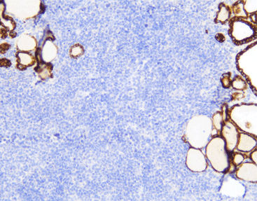 Reagente anticorpo monoclonale - CTM-0162 - Celnovte Biotechnology Co., Ltd. - anticorpo policlonale / enzima / da ricerca