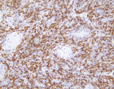 Reagente anticorpo - CBM-0042 - Celnovte Biotechnology Co., Ltd. - per citogenetica / dell'apoptosi
