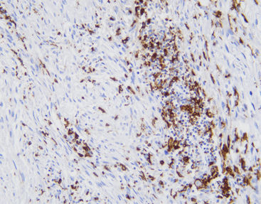 Reagente anticorpo - CCM-0702 - Celnovte Biotechnology Co., Ltd. - per tessuti / per immunoistochimica / di marcatori tumorali