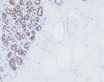 Reagente anticorpo - CSM-0181 - Celnovte Biotechnology Co., Ltd. - clinico / per immunoistochimica / oncologico