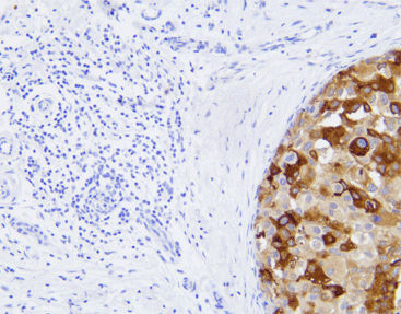Reagente anticorpo monoclonale - CMM-0112 - Celnovte Biotechnology Co., Ltd. - anticorpo policlonale / da ricerca / per tessuti