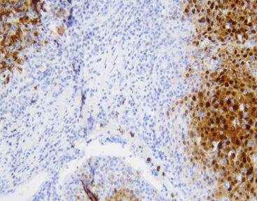 Reagente anticorpo monoclonale - CSM-0121 - Celnovte Biotechnology Co., Ltd. - anticorpo policlonale / da ricerca / per tessuti