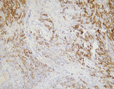 Reagente anticorpo monoclonale - CIM-0151 - Celnovte Biotechnology Co., Ltd. - anticorpo policlonale / da ricerca / per tessuti