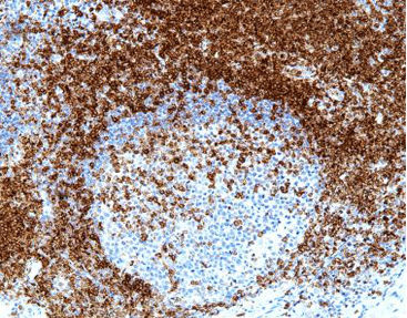 Reagente soluzione colorante - CCM-0354 - Celnovte Biotechnology Co., Ltd. - colorante / antigeno / per tessuti