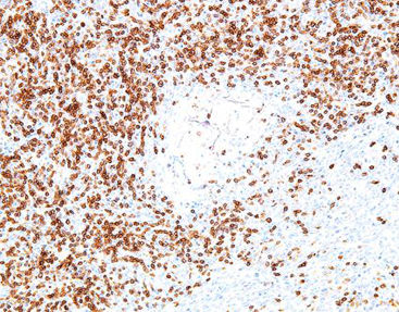 Reagente soluzione colorante - CCM-0372 - Celnovte Biotechnology Co., Ltd. - colorante / antigeno / per tessuti