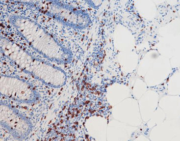 Reagente soluzione colorante - CCM-0374 - Celnovte Biotechnology Co., Ltd. - anticorpo / colorante / per tessuti