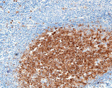 Reagente soluzione colorante - CCM-0391 - Celnovte Biotechnology Co., Ltd. - colorante / antigeno / per tessuti