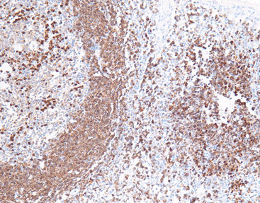 Reagente soluzione colorante - CCM-0734 - Celnovte Biotechnology Co., Ltd. - anticorpo / per tessuti / per citologia
