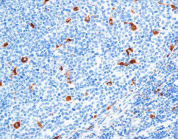 Reagente anticorpo - CCM-0701 - Celnovte Biotechnology Co., Ltd. - soluzione colorante / lisozima / colorante