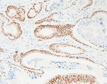 Reagente soluzione colorante - CCR-0822 - Celnovte Biotechnology Co., Ltd. - anticorpo / colorante / per tessuti