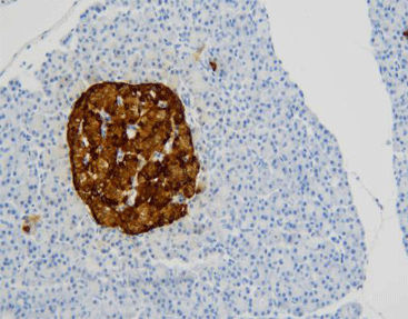Reagente soluzione colorante - CCM-0852 - Celnovte Biotechnology Co., Ltd. - anticorpo / colorante / per tessuti