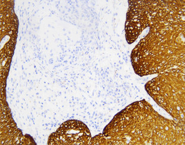 Reagente soluzione colorante - CCM-0983 - Celnovte Biotechnology Co., Ltd. - anticorpo / colorante / clinico